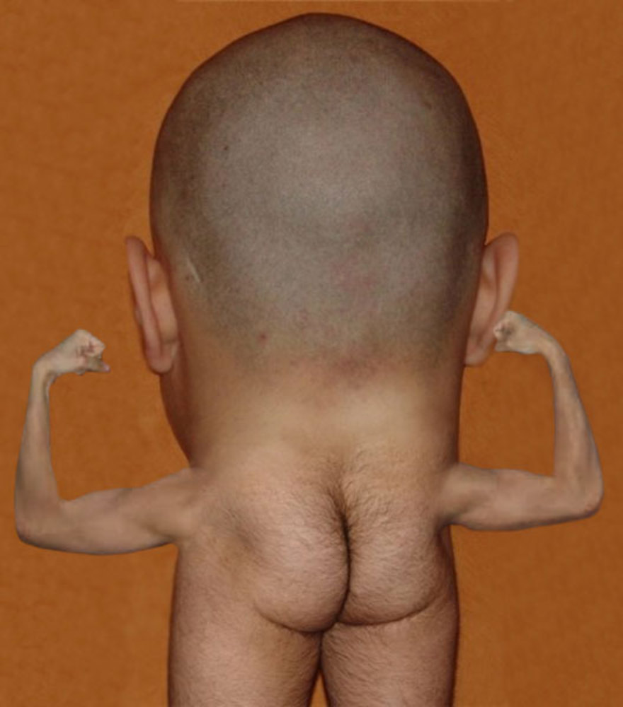 103