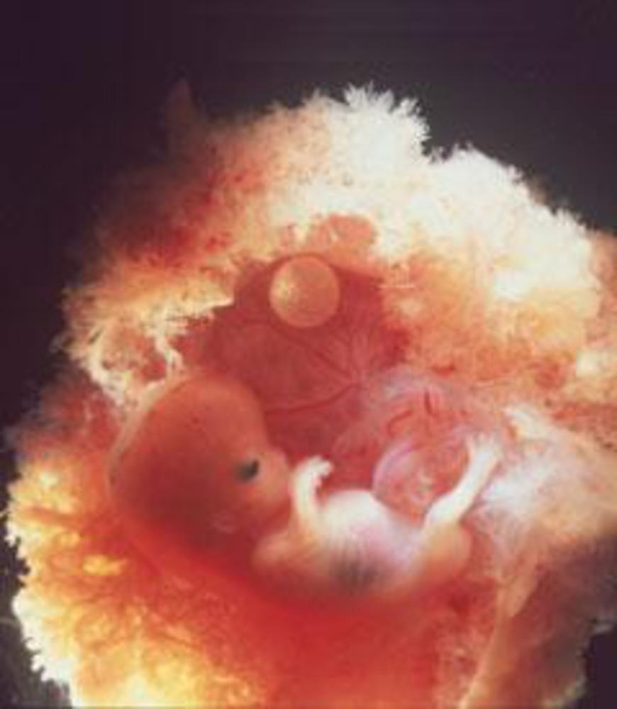 Видео 10 недели. 10 Недель беременности фото плода. Эмбрион на 10 неделе беременности фото. Плод ребенка 10 недель беременности фото. Плод в 8-10 недель беременности.