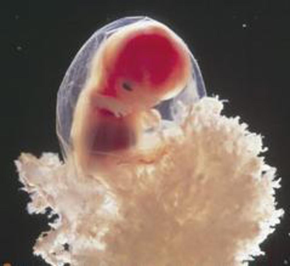 Как выглядит ребенок в 8 недель беременности фото