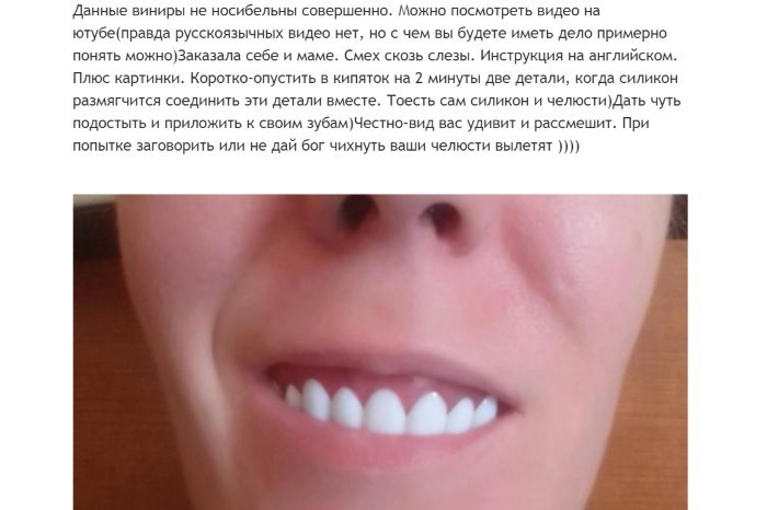 Не могу лизать у меня виниры песня. Perfect smile Veneers накладные виниры. Виниры тру Смайл. Виниры Перфект Смайл отзывы реальные. Виниры perfect smile Veneers инструкция.