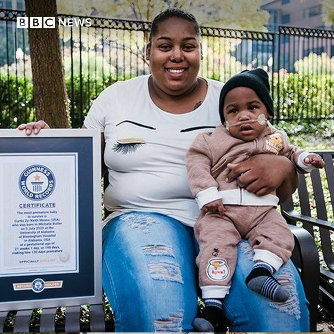 Сколько рожала женщина рекорд. Рекорды детей. Новорожденный из книги рекордов. Самый недоношенный ребенок в мире. Michelle Butler.