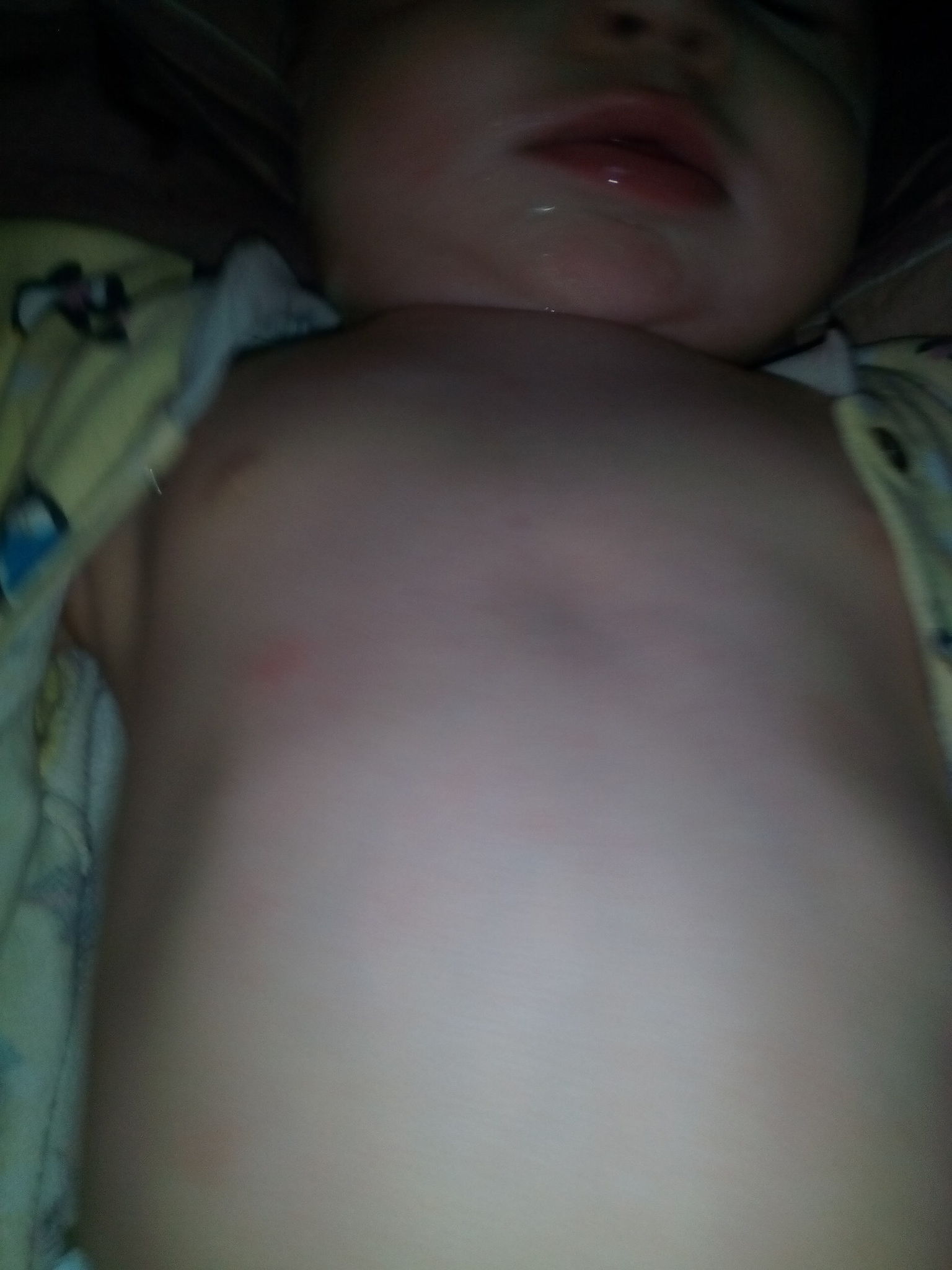 у новорожденного припухла одна грудь фото 48