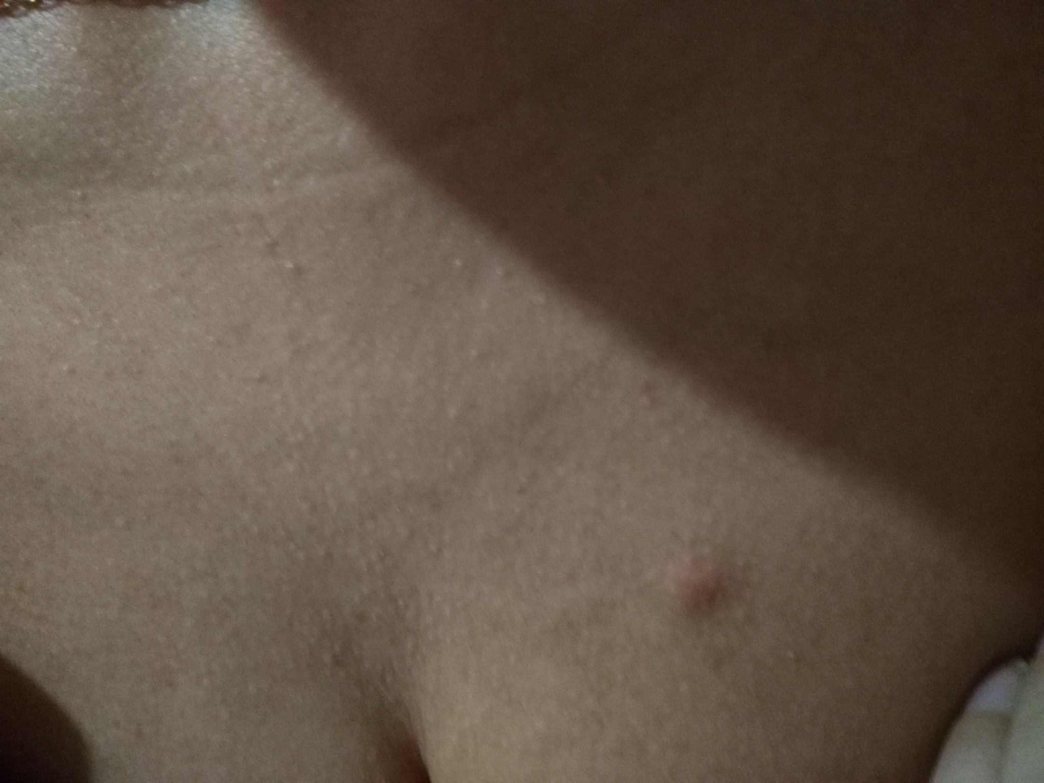 уплотнение в районе груди мужчин фото 46