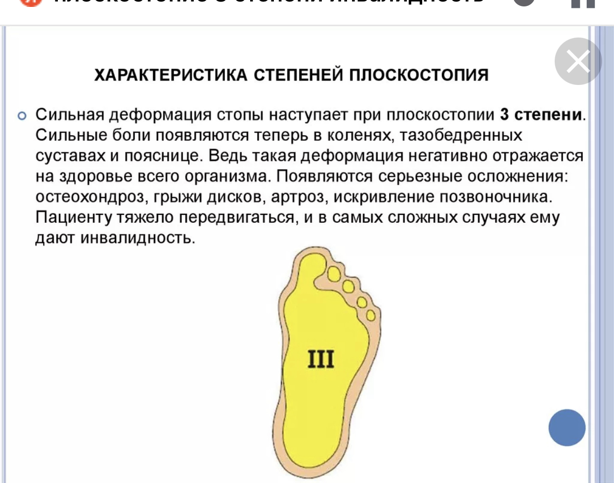 Степени плоскостопия. Параметры поперечного плоскостопия. Плоскостопие 3 степени параметры. Описание продольного плоскостопия. 3-Я степень продольного плоскостопия.